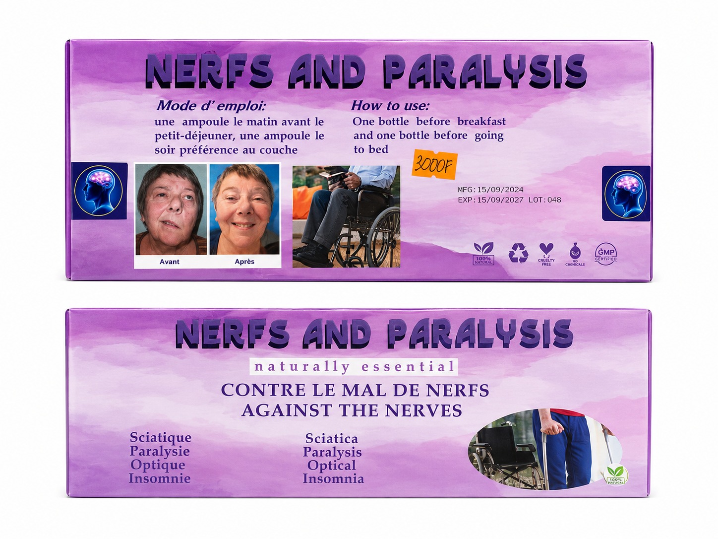 NERFS AND PARALYSIS 